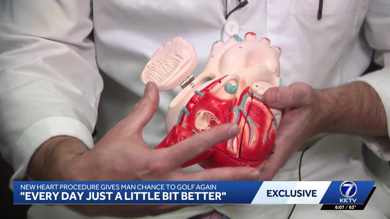 New heart procedure helps man swing a golf club again — WISN 12 Milwaukee, Wahpeton Community news